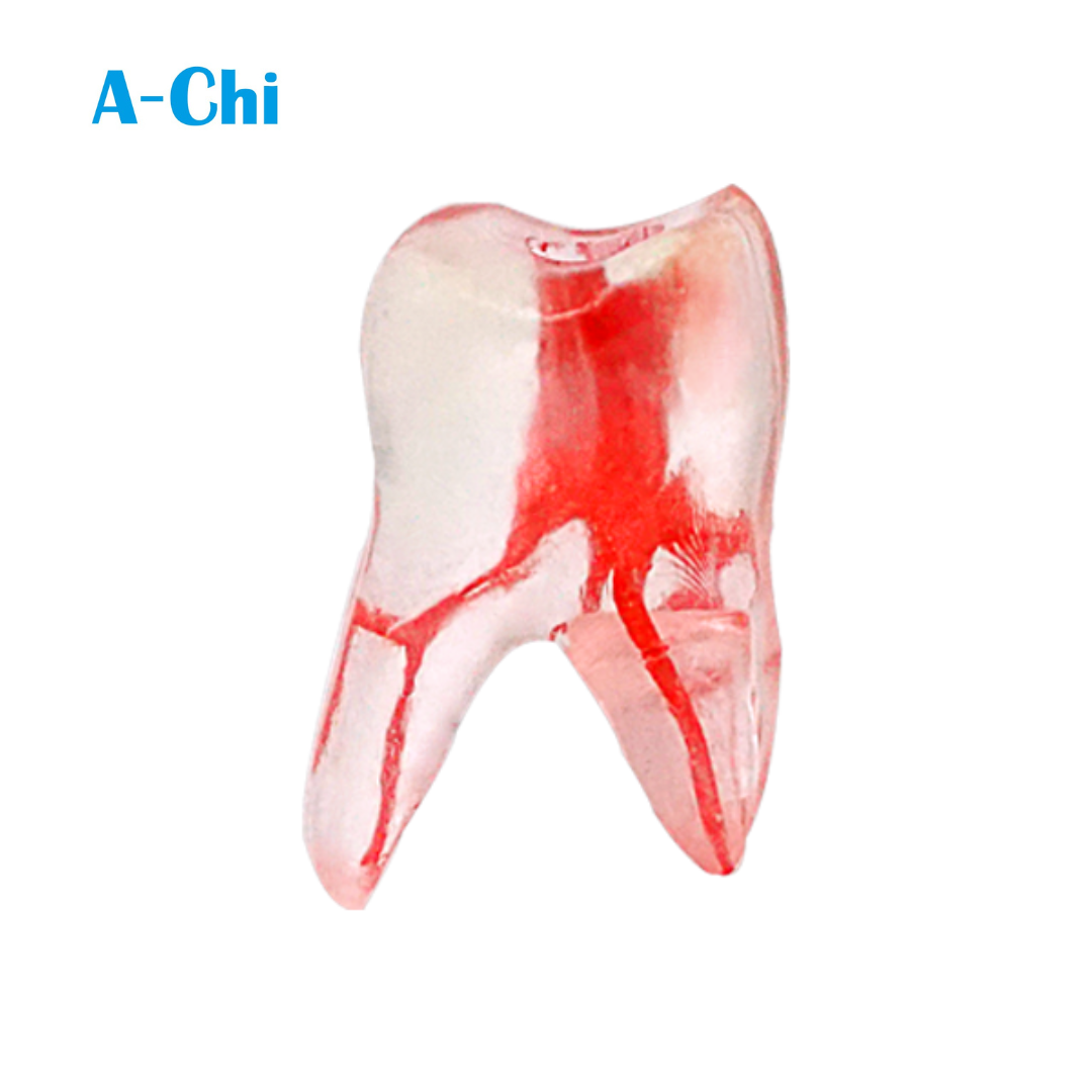 Maxillary First Molar